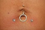 Dermal Anchor - Implantat